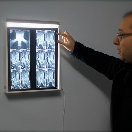 Cyriax persona revisando radiografía