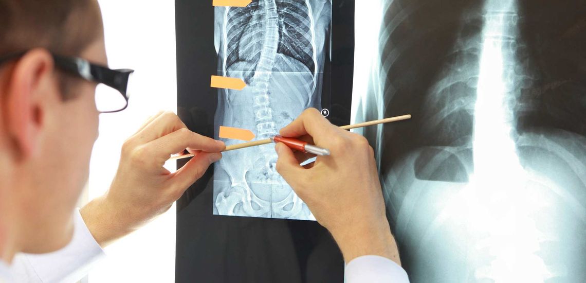 Medico con radiografía